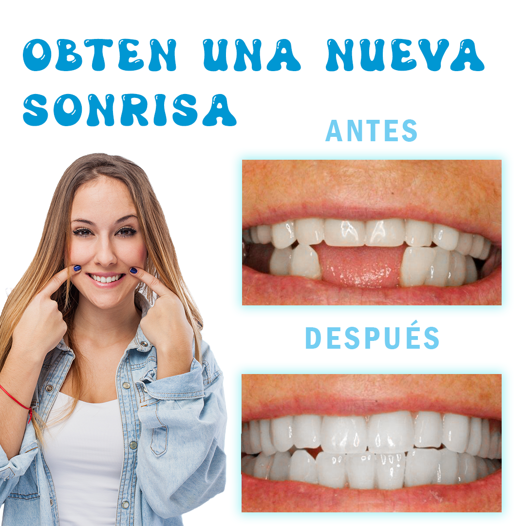 Otro